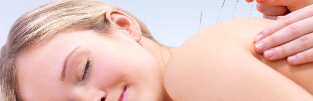 acupuncture Leeuwarden